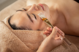 Are Chemical Peels Worth the Hype
