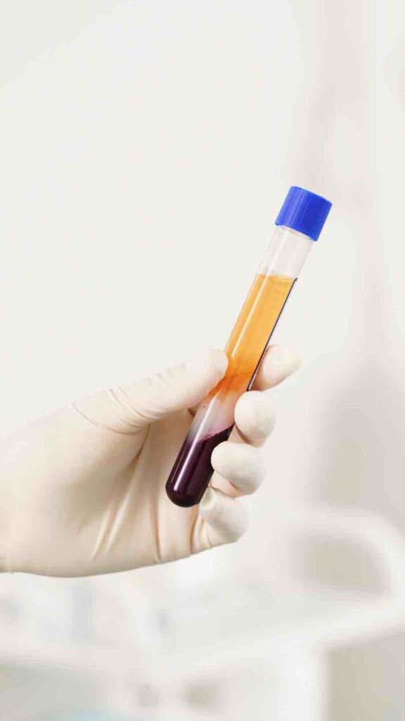 O-shot-PRP
